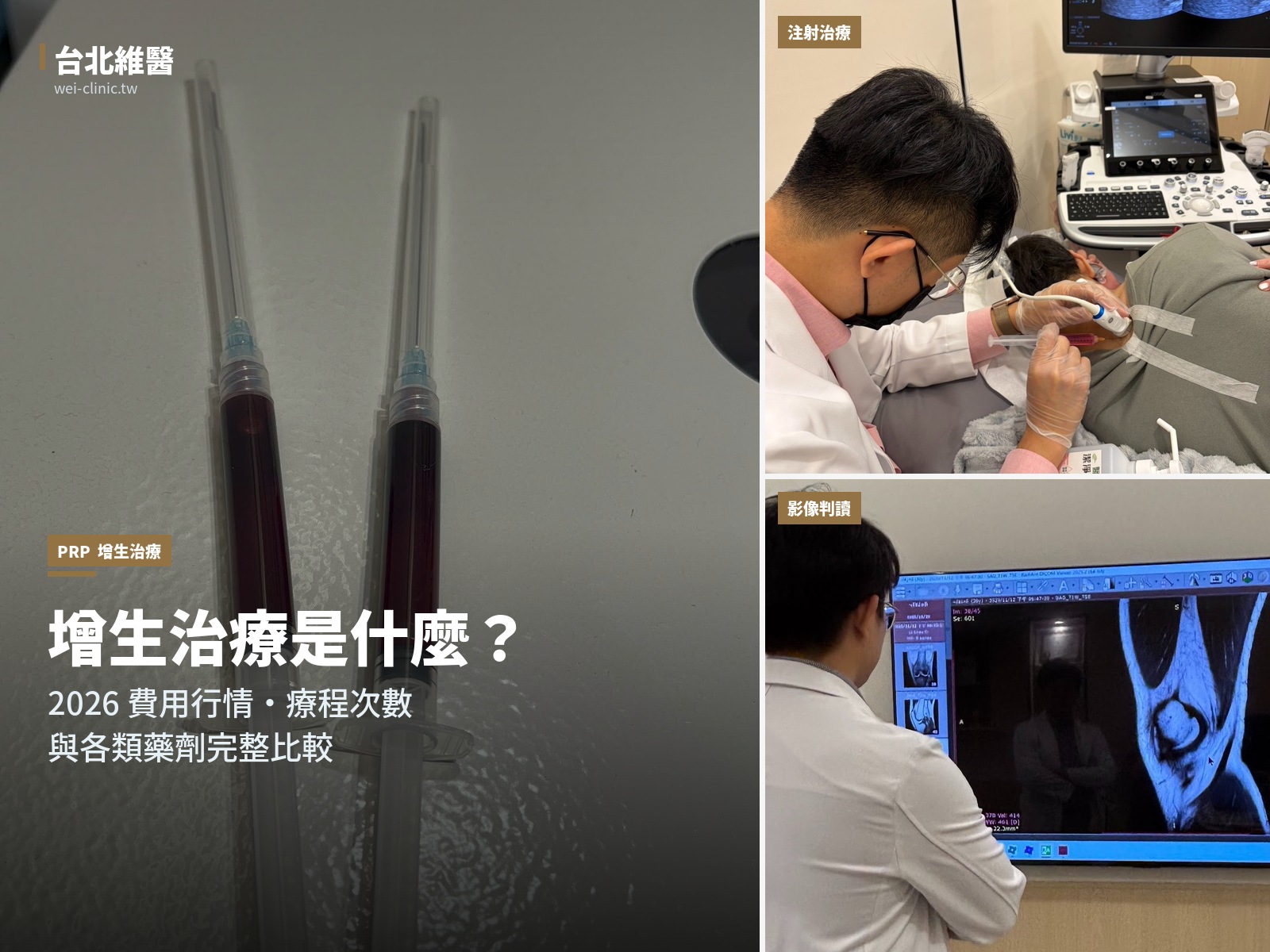 增生治療是什麼？2026 費用行情、療程次數與各類藥劑比較